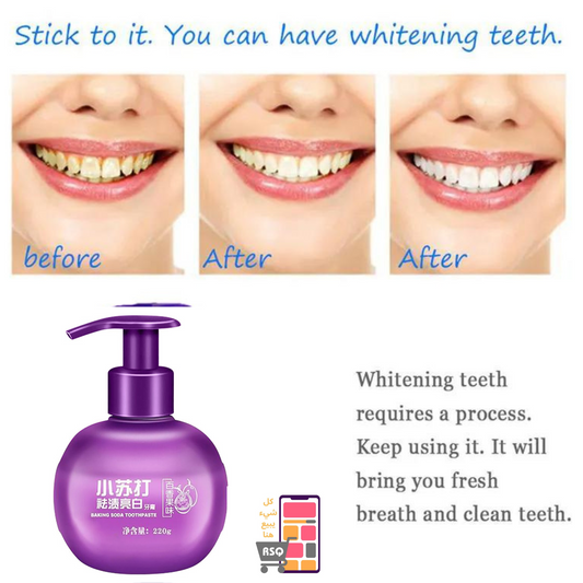 Baking soda Teeth's whitening toothpaste(FREE DELIVERY)